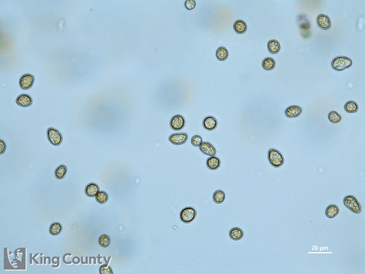 Photo of Heterosigma akashiwo